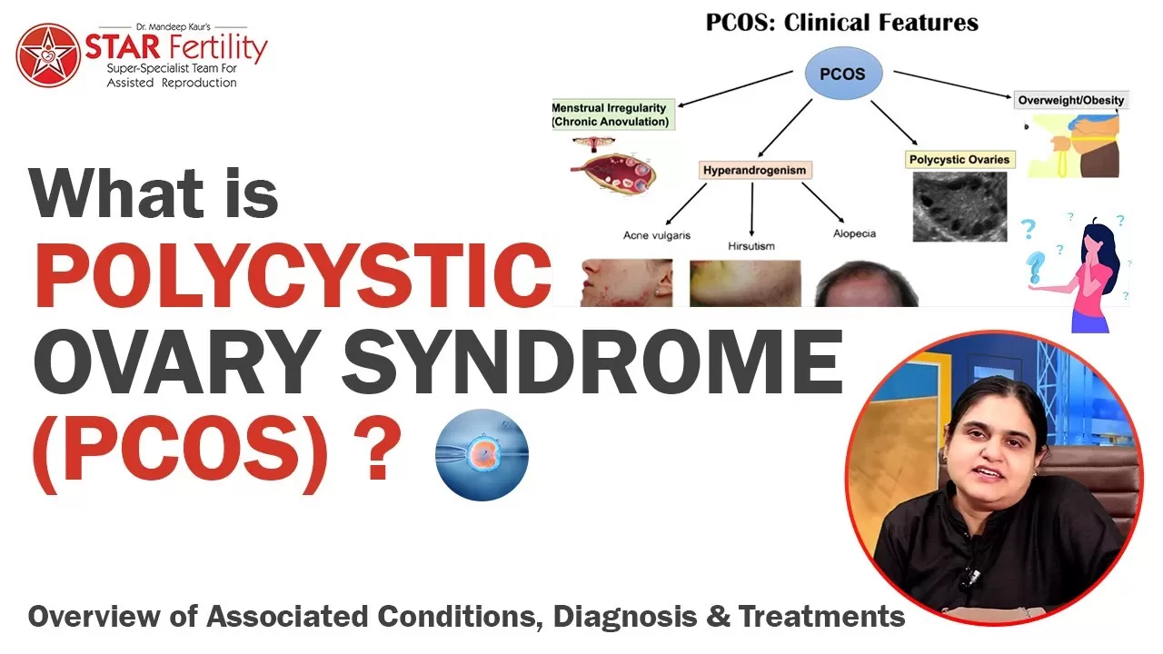pcod treatment